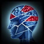 BrainInjury1 BrainInjury1